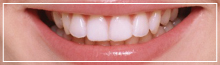 1口腔単位の歯科治療